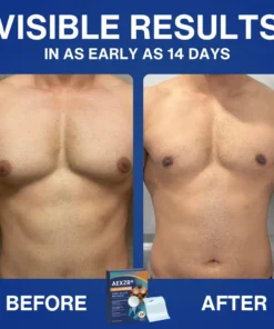 AEXZR® Nano-Microneedle Chest-Sculpt Bio-Patch (𝐉𝐮𝐬𝐭 𝐨𝐧𝐜𝐞 𝐚 𝐝𝐚𝐲, 𝐯𝐢𝐬𝐢𝐛𝐥𝐞 𝐜𝐡𝐚𝐧𝐠𝐞𝐬 𝐢𝐧 𝟕 𝑫𝐚𝐲𝐬 𝐅𝐨𝐫 𝐆𝐲𝐧𝐞𝐜𝐨𝐦𝐚𝐬𝐭𝐢𝐚, 𝐄𝐱𝐜𝐞𝐬𝐬 𝐂𝐡𝐞𝐬𝐭 𝐅𝐚𝐭, 𝐒𝐚𝐠𝐠𝐢𝐧𝐠 𝐒𝐤𝐢𝐧, 𝙇𝙊𝙊𝙎𝗘 𝗦𝗞𝗜𝗡, 𝐚𝐧𝐝 𝐦𝐨𝐫𝐞