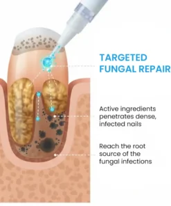 AEXZR® NanoFix Repair Pen