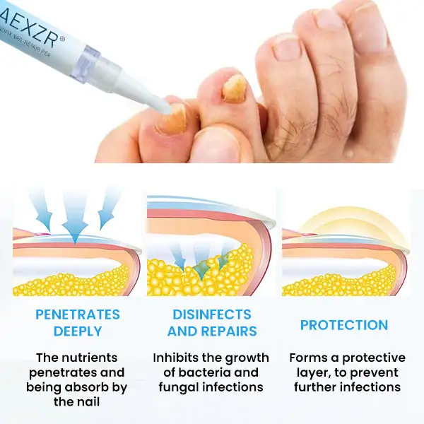 AEXZR® NanoFix Repair Pen