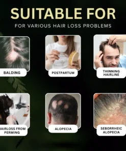 AEXZR® Non-Minoxidil Scalp Recovery