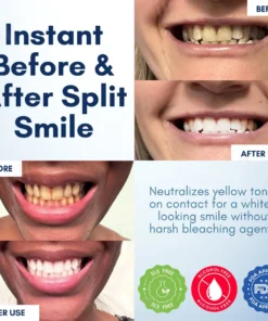 AEXZR® Pro-Bright Teeth Gloss - Instant Radiant Smile