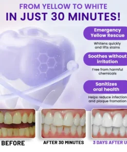 AEXZR® V34 Whitening Strips