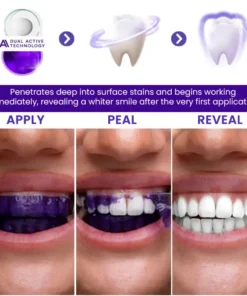 AEXZR® V34 Whitening Strips
