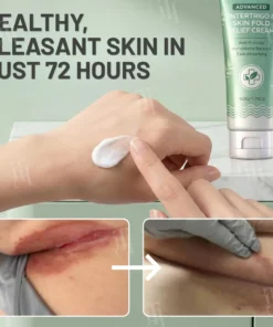 AEXZR® Advanced Intertrigo & Skin Fold Relief Cream