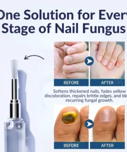 AEXZR® Next-Gen Antifungal Max-Pen (𝐕𝐢𝐬𝐢𝐛𝐥𝐞 𝐫𝐞𝐬𝐮𝐥𝐭𝐬 𝐢𝐧 𝟕 𝐝𝐚𝐲𝐬) 𝐅𝐨𝐫 𝐍𝐚𝐢𝐥 𝐅𝐮𝐧𝐠𝐮𝐬, 𝐃𝐢𝐬𝐜𝐨𝐥𝐨𝐫𝐞𝐝 𝐍𝐚𝐢𝐥𝐬, 𝐁𝐫𝐢𝐭𝐭𝐥𝐞 𝐍𝐚𝐢𝐥𝐬, 𝐚𝐧𝐝 𝐦𝐨𝐫𝐞