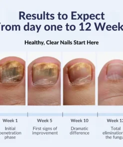 AEXZR® Next-Gen Antifungal Max-Pen