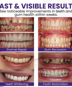 AEXZR® Smileagain Bee Venom Oral Treatment Powder