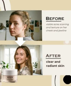 AEXZR® Advanced Precision Dark Spot Corrector