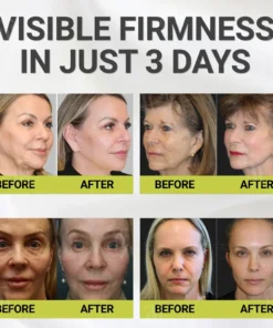 AEXZR® Botox & Vita-A Retinol Shot Wrinkle - Lift Tightening Cream