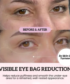 AEXZR® Topical Regenerative Repair Eye Patch