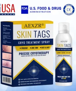 AEXZR® cryotherapy Spray: Quick removal of warts and corneas - results visible in 7 days