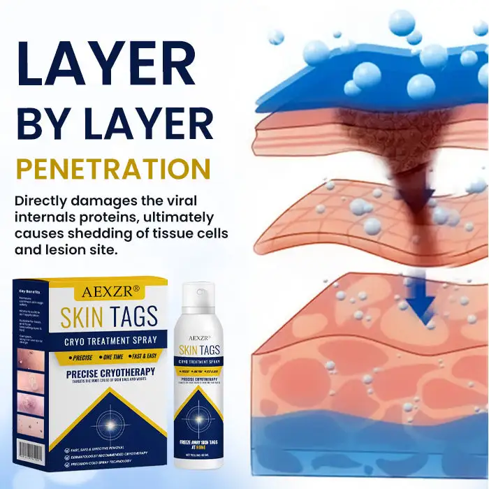 AEXZR® cryotherapy Spray: Quick removal of warts and corneas - results visible in 7 days