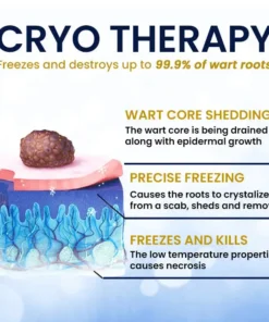 AEXZR® cryotherapy Spray: Quick removal of warts and corneas - results visible in 7 days