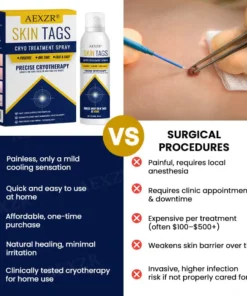 AEXZR® cryotherapy Spray: Quick removal of warts and corneas - results visible in 7 days