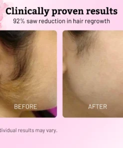 AEXZR®Pain-Free Hair Removal Alternative – Gentle, Soothing, No Harsh Chemicals