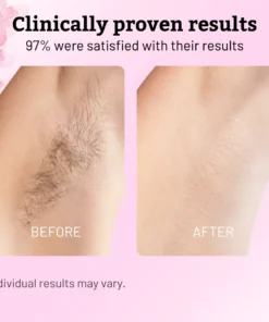 AEXZR®Pain-Free Hair Removal Alternative – Gentle, Soothing, No Harsh Chemicals