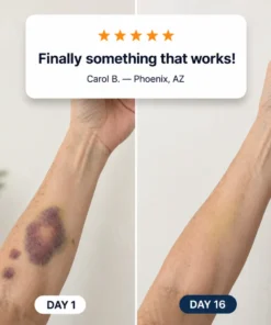AEXZR® Bruise Repair + SPF 30 Skin-Strengthening Cream