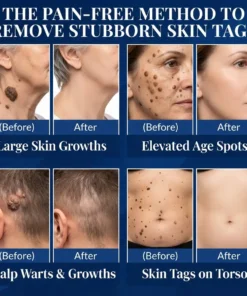 AEXZR® Smart-Shield Derma-Gel 7-Day Skin Tag & Pigment Spot Eraser